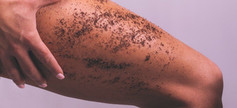 How to Reduce the appearance of Stretch-marks